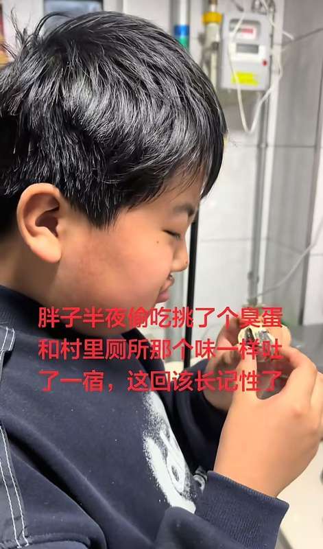 儿童肥胖与黑棘皮症:被忽视的健康信号与科学干预路径 健康养生